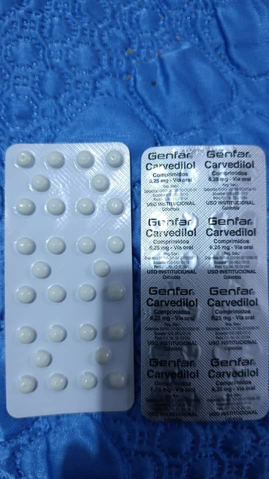Carvedilol